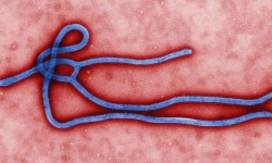 Ebola Virus